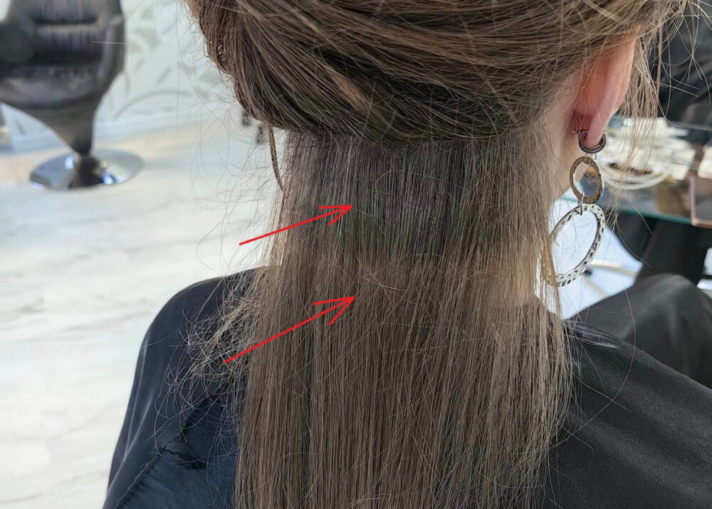 Can birth control pills change hair color?